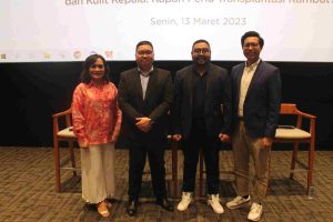 Bamed Hair Care: Layanan Baru Solusi Komprehensif Masalah Kesehatan Rambut dan Kulit Kepala: Kapan Perlu Transplantasi Rambut?