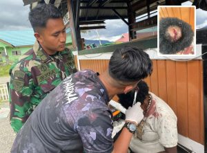 Satgas Yonif 330 Kostrad Beri Pertolongan Pertama Kepada Mama Tabuni Yang Kepalanya Terluka