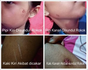 BEJAT AYAH DIDUGA MEMILIKI SENJATA API ANIAYA ANAK KANDUNG DI BAWAH UMUR DENGAN KEJAM